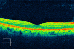 A picture of the sun 's rays in an image.